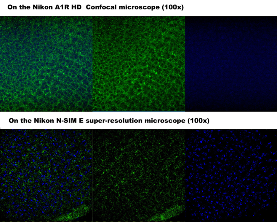 l3-eye-disc-cf-vs-sim_edited-5